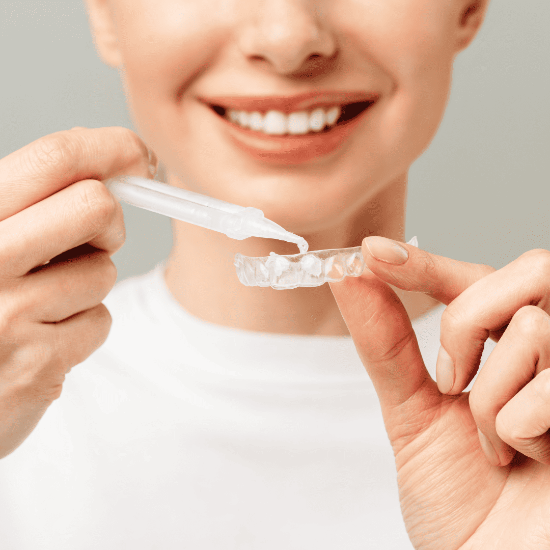 Tooth whitening