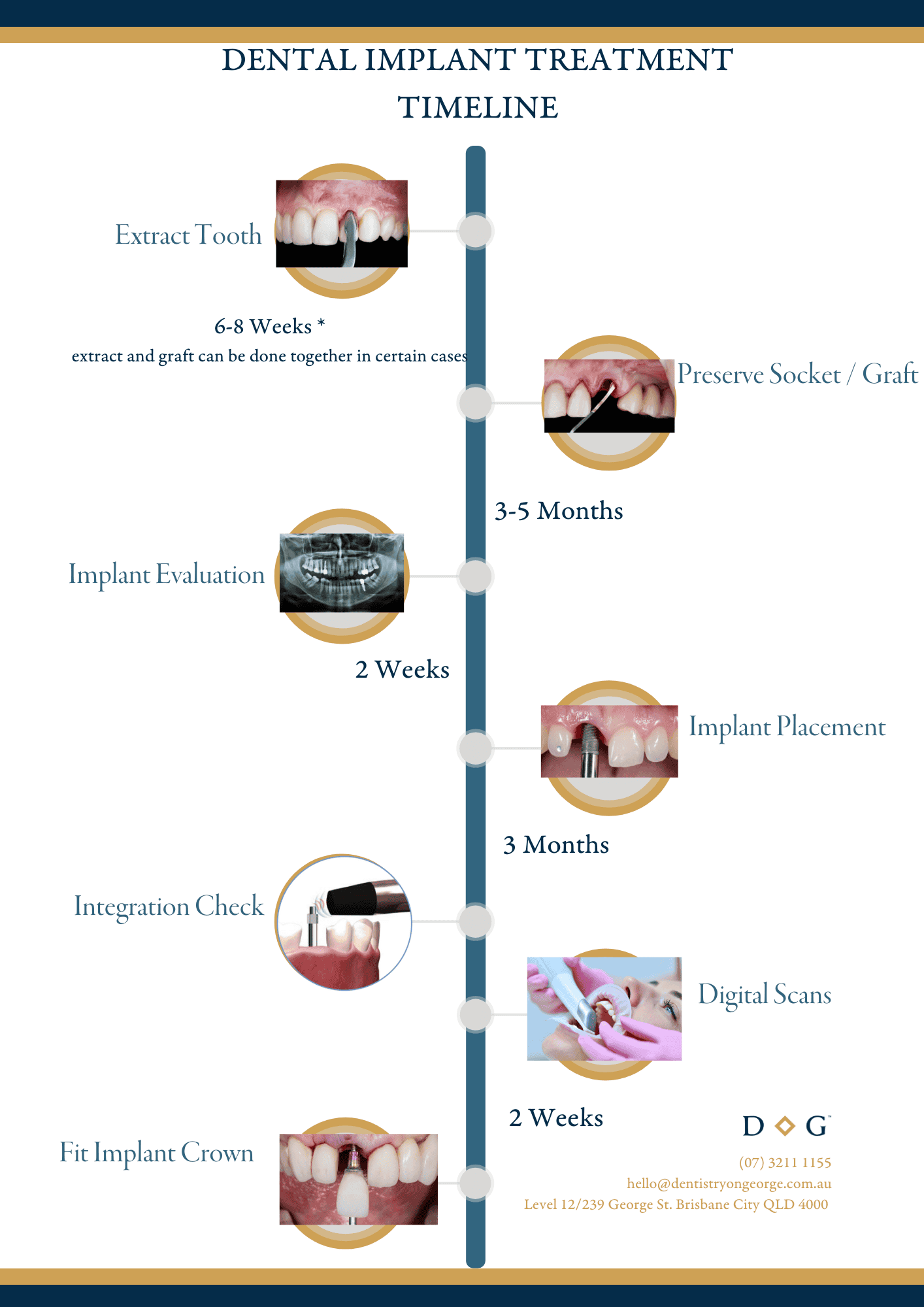 Dental Implant Timeline