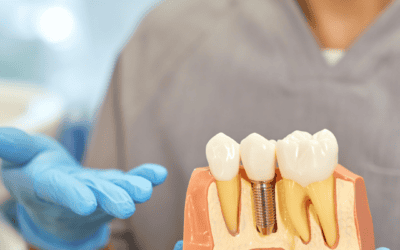 The Future of Smiles: A Comprehensive Guide to Dental Implants